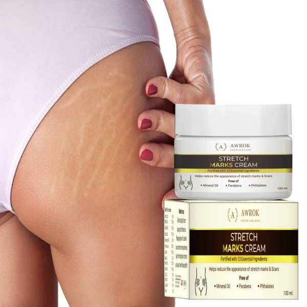 stretch marks cream