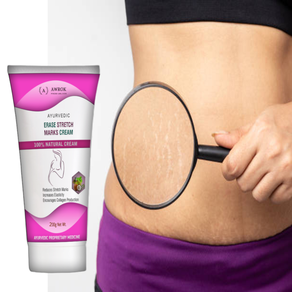 Stretch Mark Cream